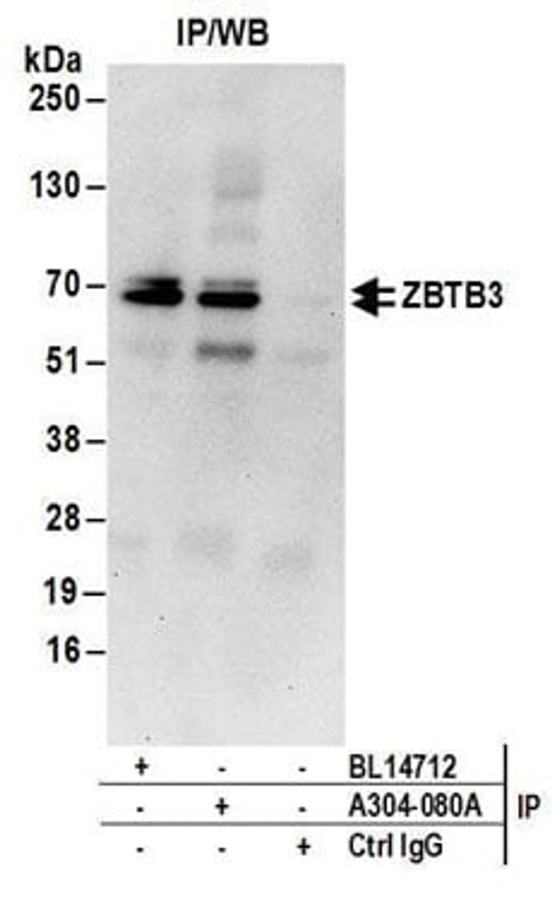 Detection of human ZBTB3 by western blot of immunoprecipitates.