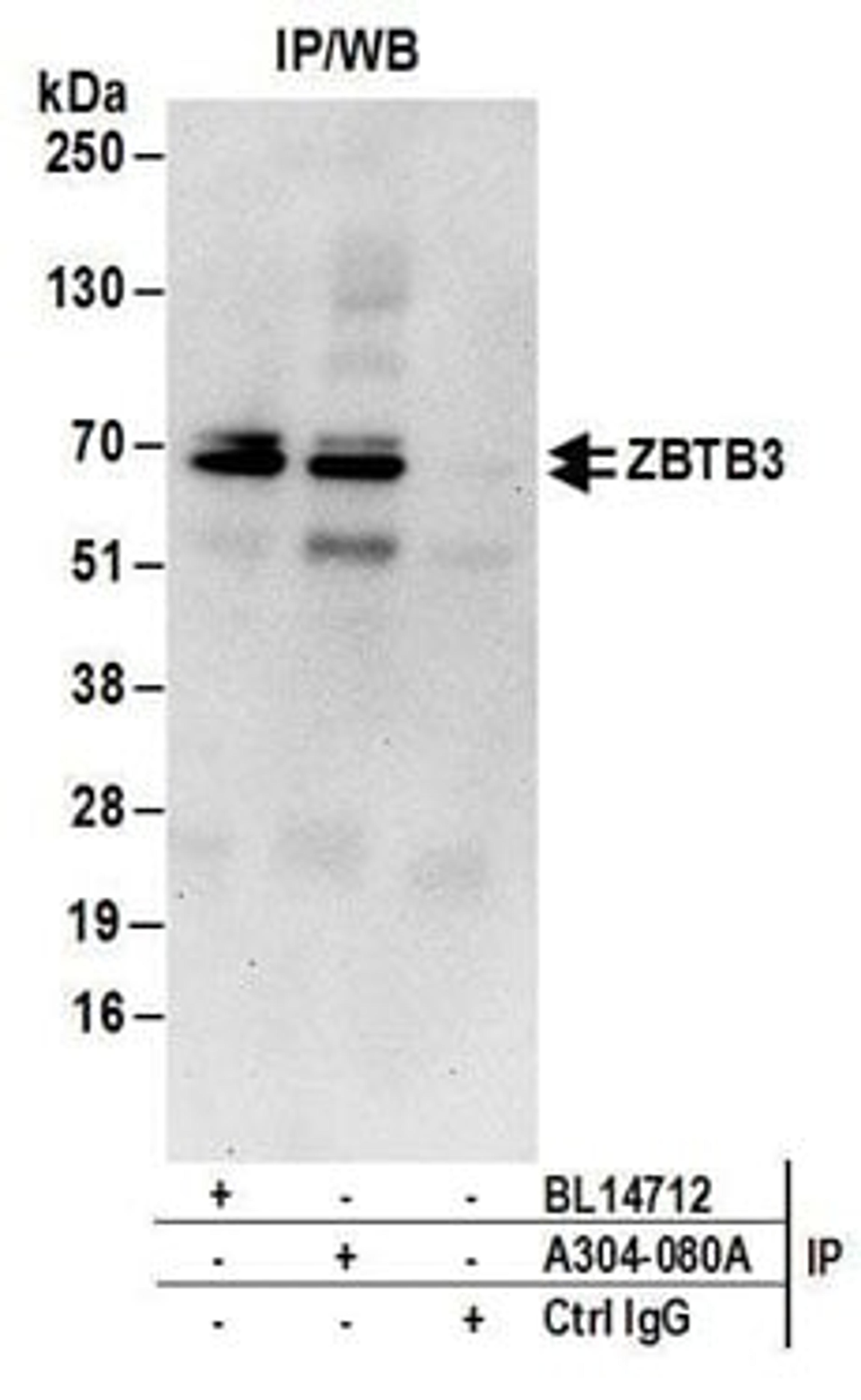 Detection of human ZBTB3 by western blot of immunoprecipitates.