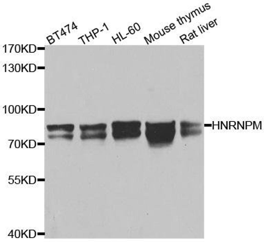 Western blot analysis of extracts of various cell lines using HNRNPM antibody