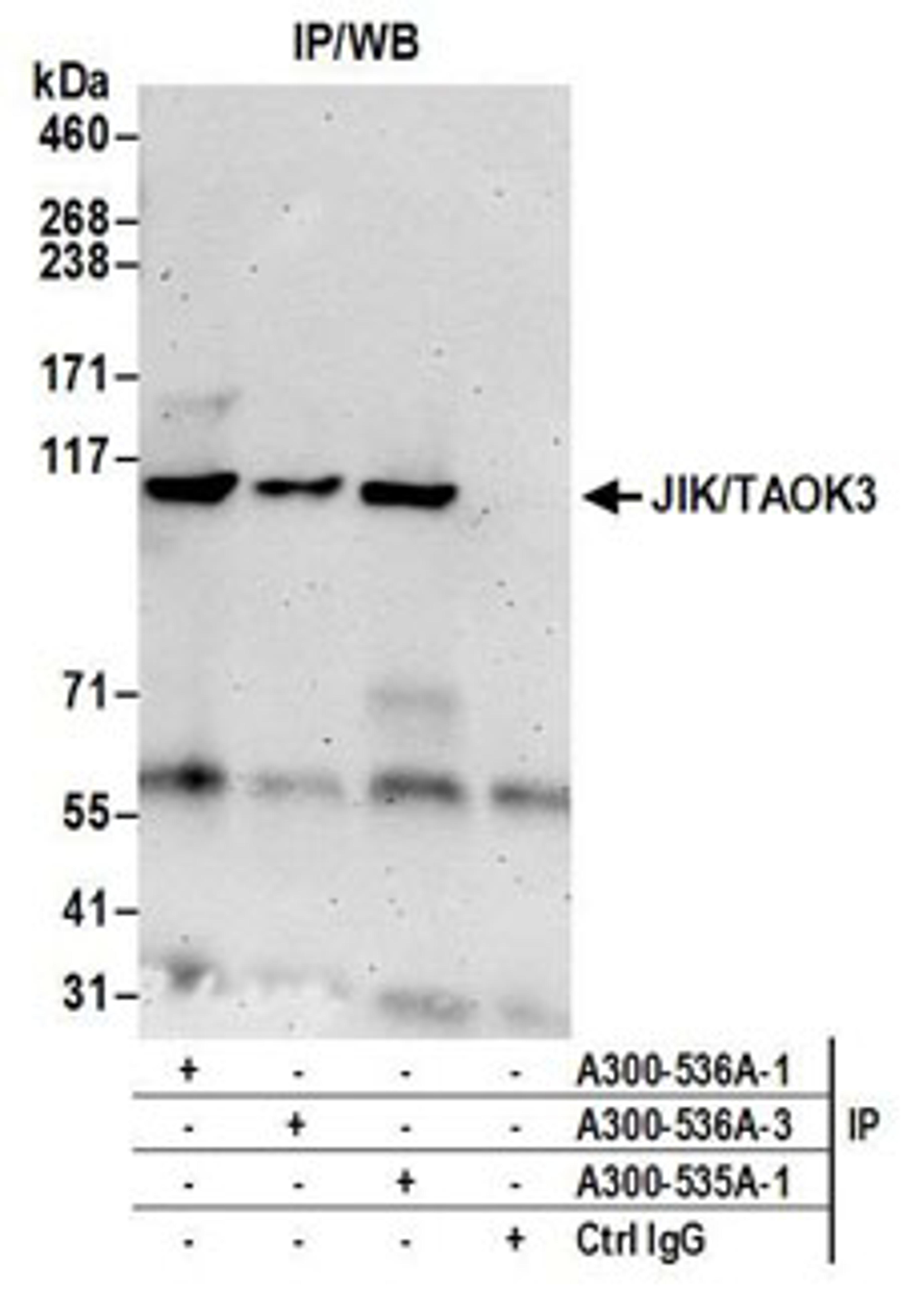 Detection of human JIK/TAOK3 by western blot of immunoprecipitates.