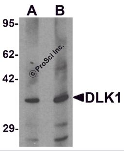 Western blot analysis of HepG2 in 293 cell lysate with DLK1 antibody at (A) 1 and (B) 2 &#956;g/mL.