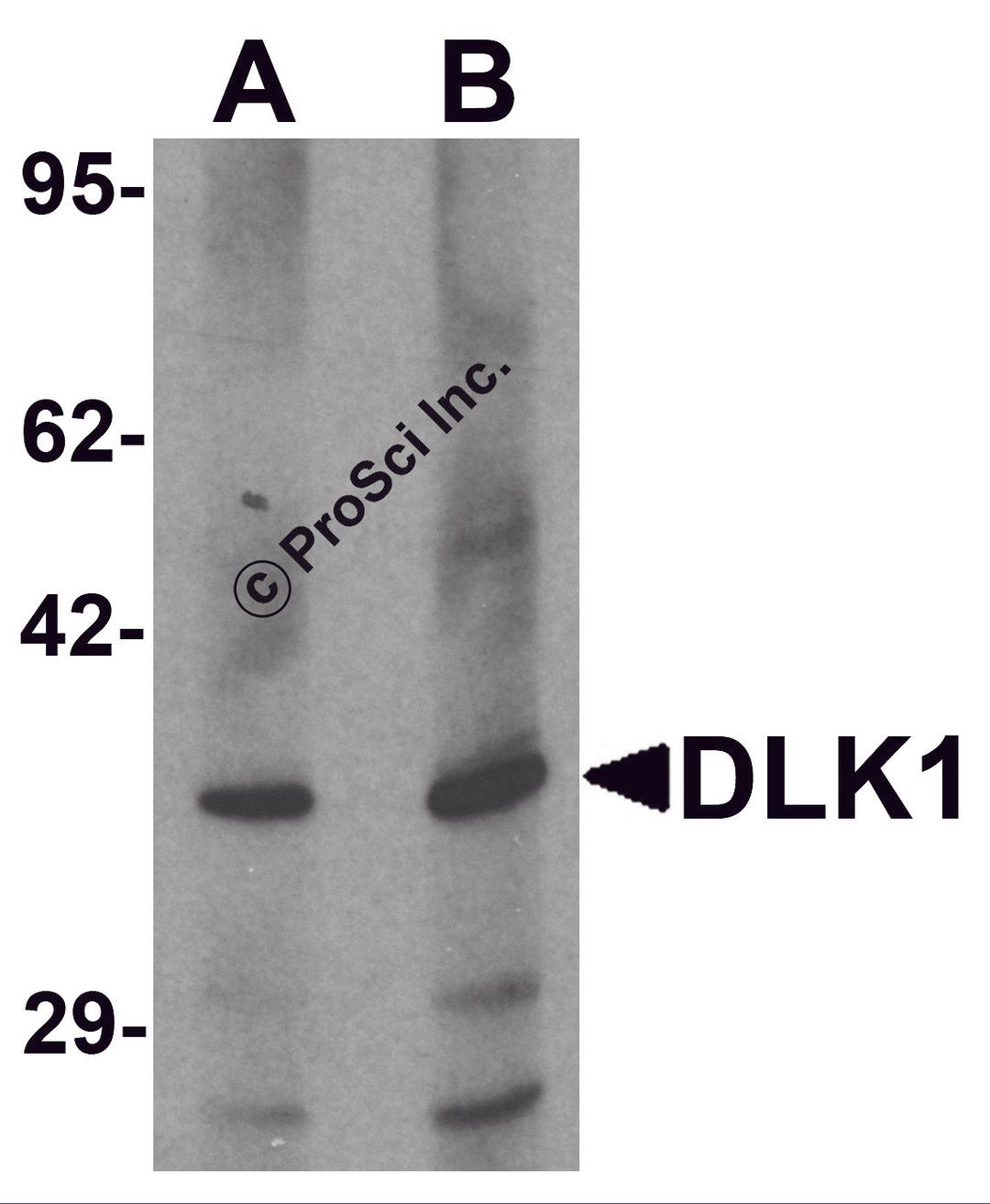 Western blot analysis of HepG2 in 293 cell lysate with DLK1 antibody at (A) 1 and (B) 2 μg/mL.