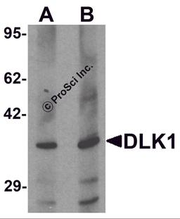 Western blot analysis of HepG2 in 293 cell lysate with DLK1 antibody at (A) 1 and (B) 2 μg/mL.