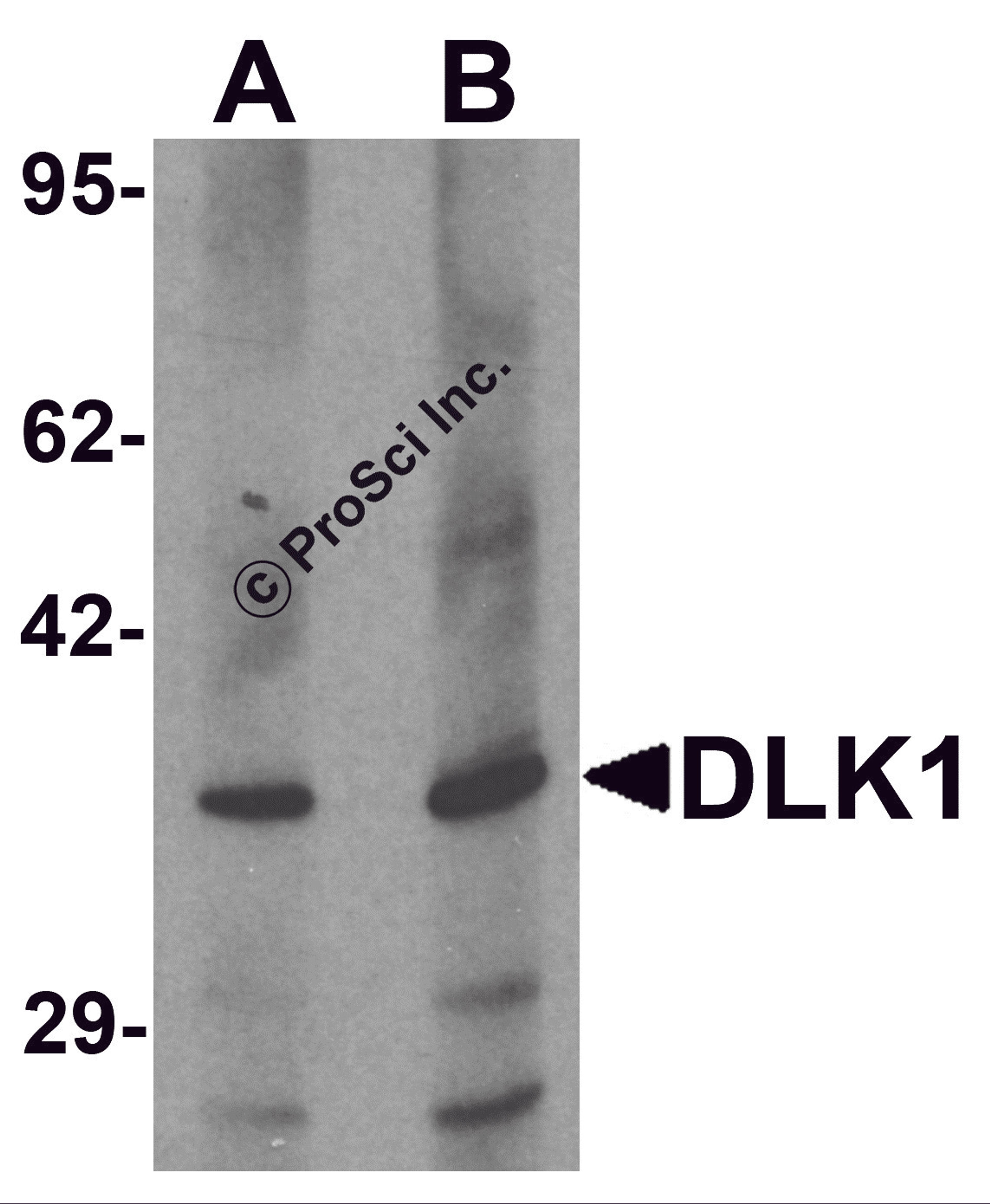 Western blot analysis of HepG2 in 293 cell lysate with DLK1 antibody at (A) 1 and (B) 2 μg/mL.
