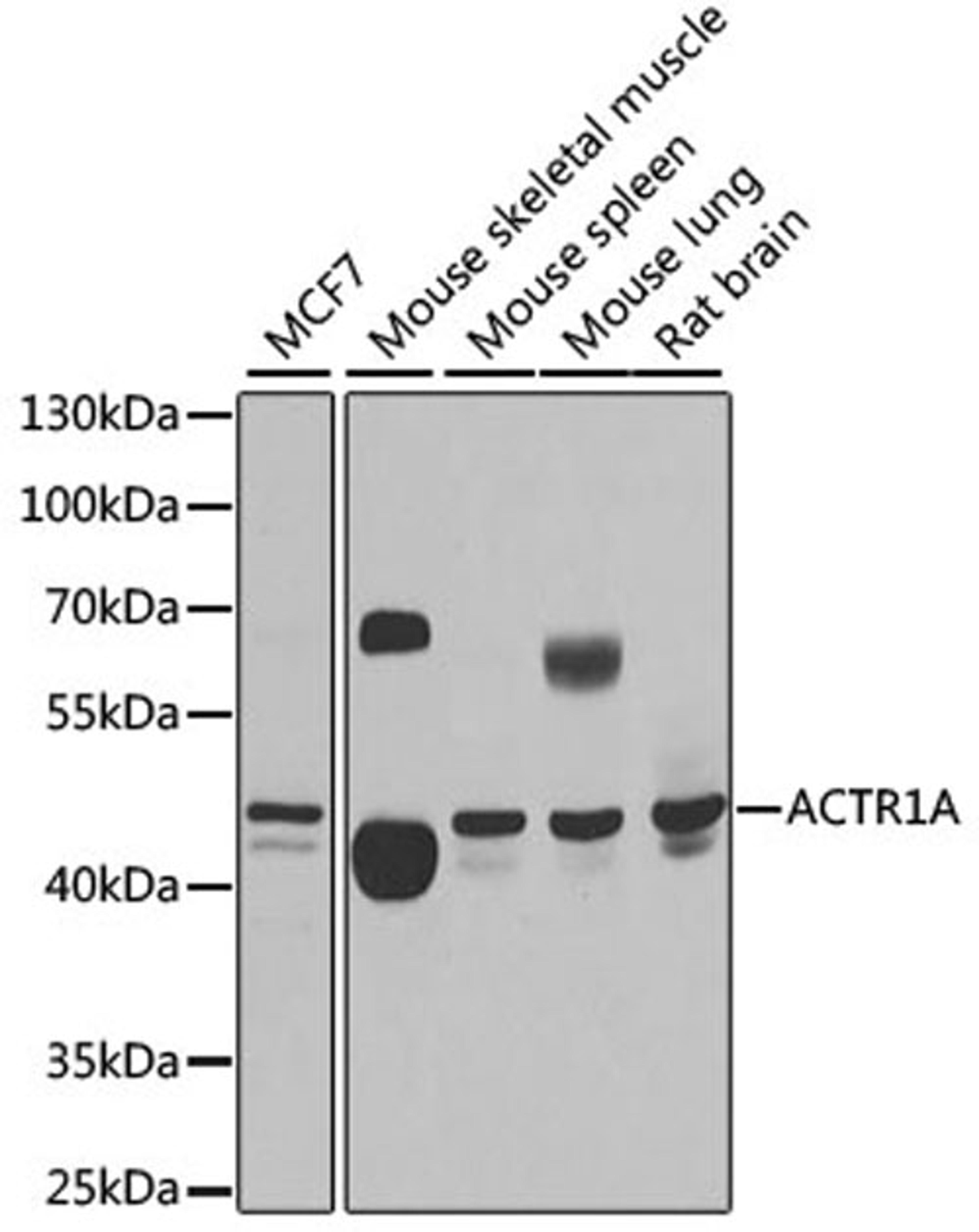 Western blot - ACTR1A antibody (A6515)