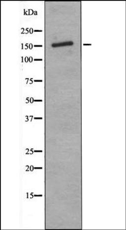 Western blot analysis of PMA treated K562 whole cell lysates using ASK1 -Phospho-Thr838- antibody