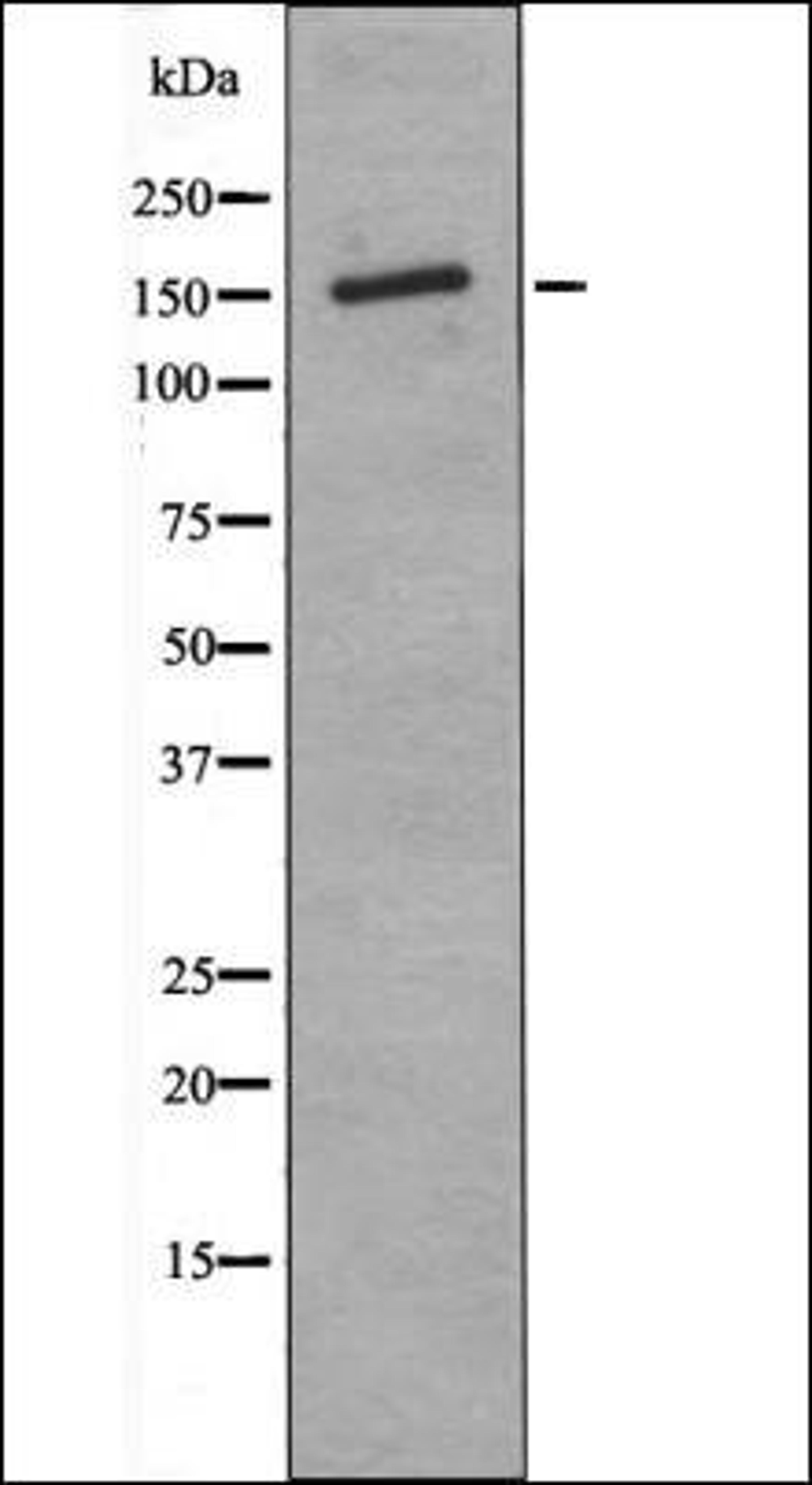 Western blot analysis of PMA treated K562 whole cell lysates using ASK1 -Phospho-Thr838- antibody