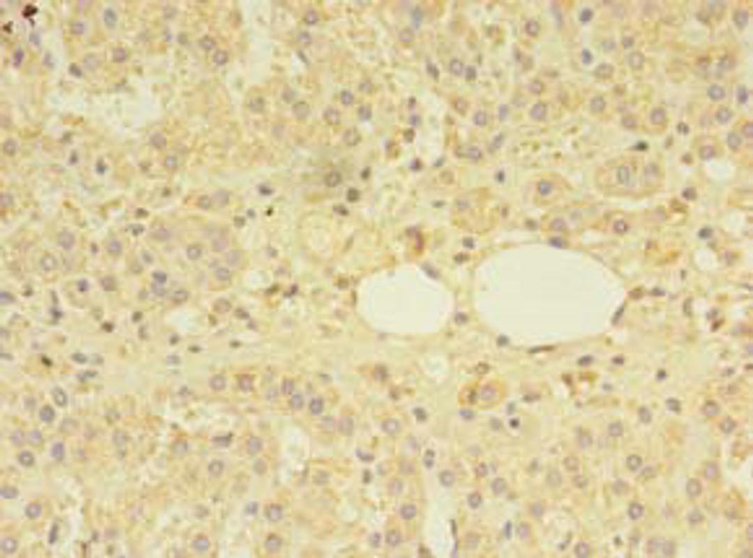 Immunohistochemistry of paraffin-embedded human adrenal gland tissue using CSB-PA859939LA01HU at dilution of 1:100