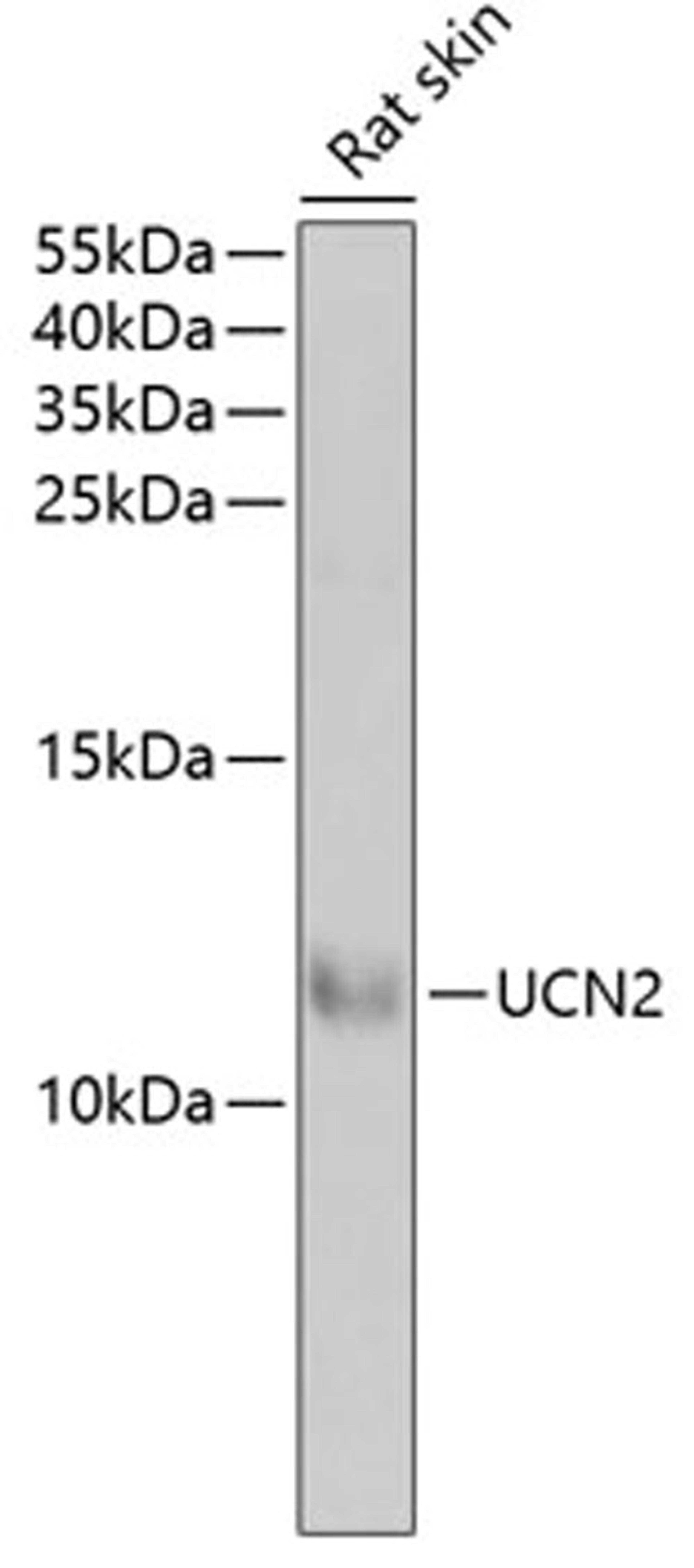 Western blot - UCN2 antibody (A6485)