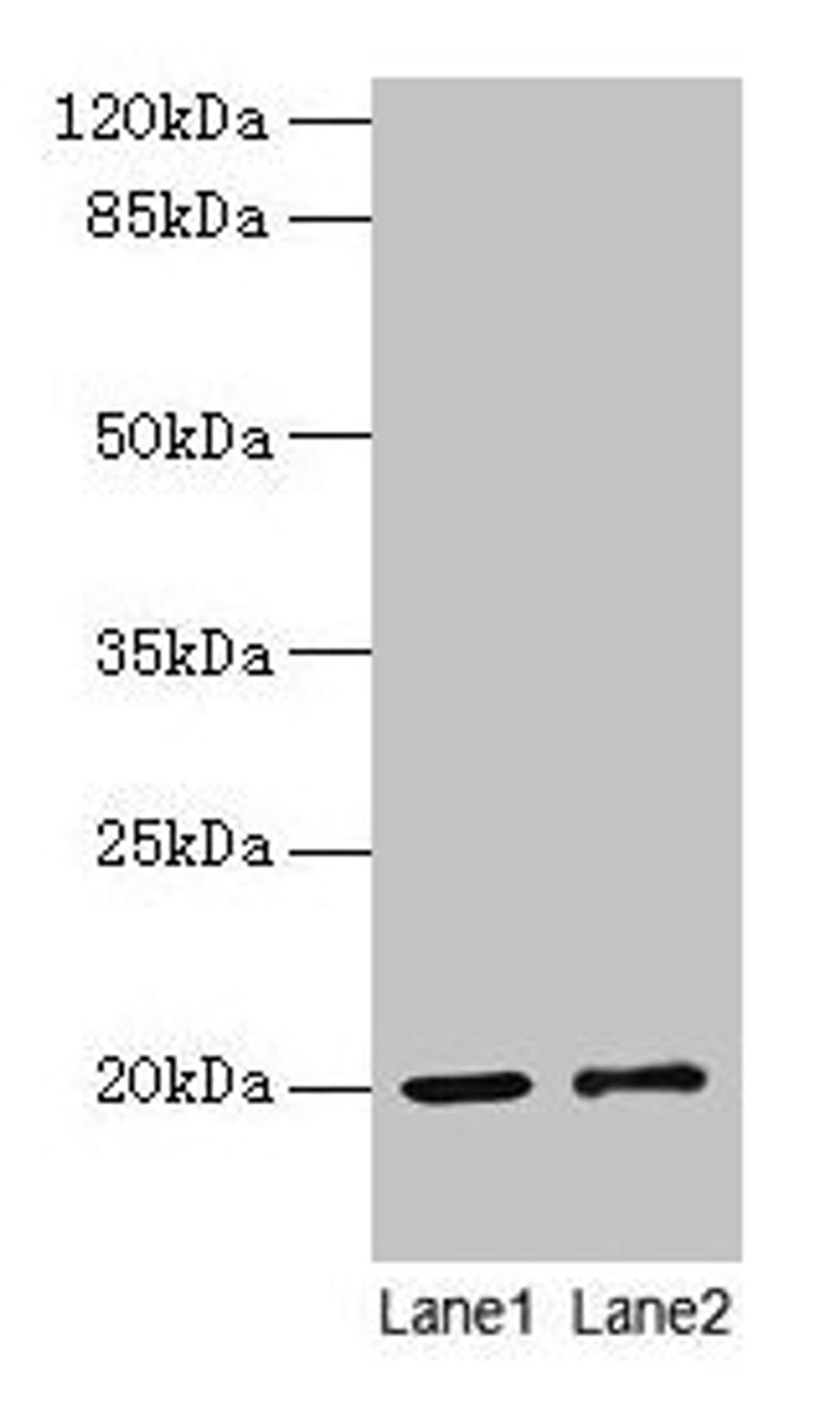 Western blot. All lanes: COX4I1 antibody at 10µg/ml. Lane 1: Rat muscle tissue. Lane 2: Zebrafish lysate. Secondary. Goat polyclonal to rabbit IgG at 1/10000 dilution. Predicted band size: 20 kDa. Observed band size: 20 kDa