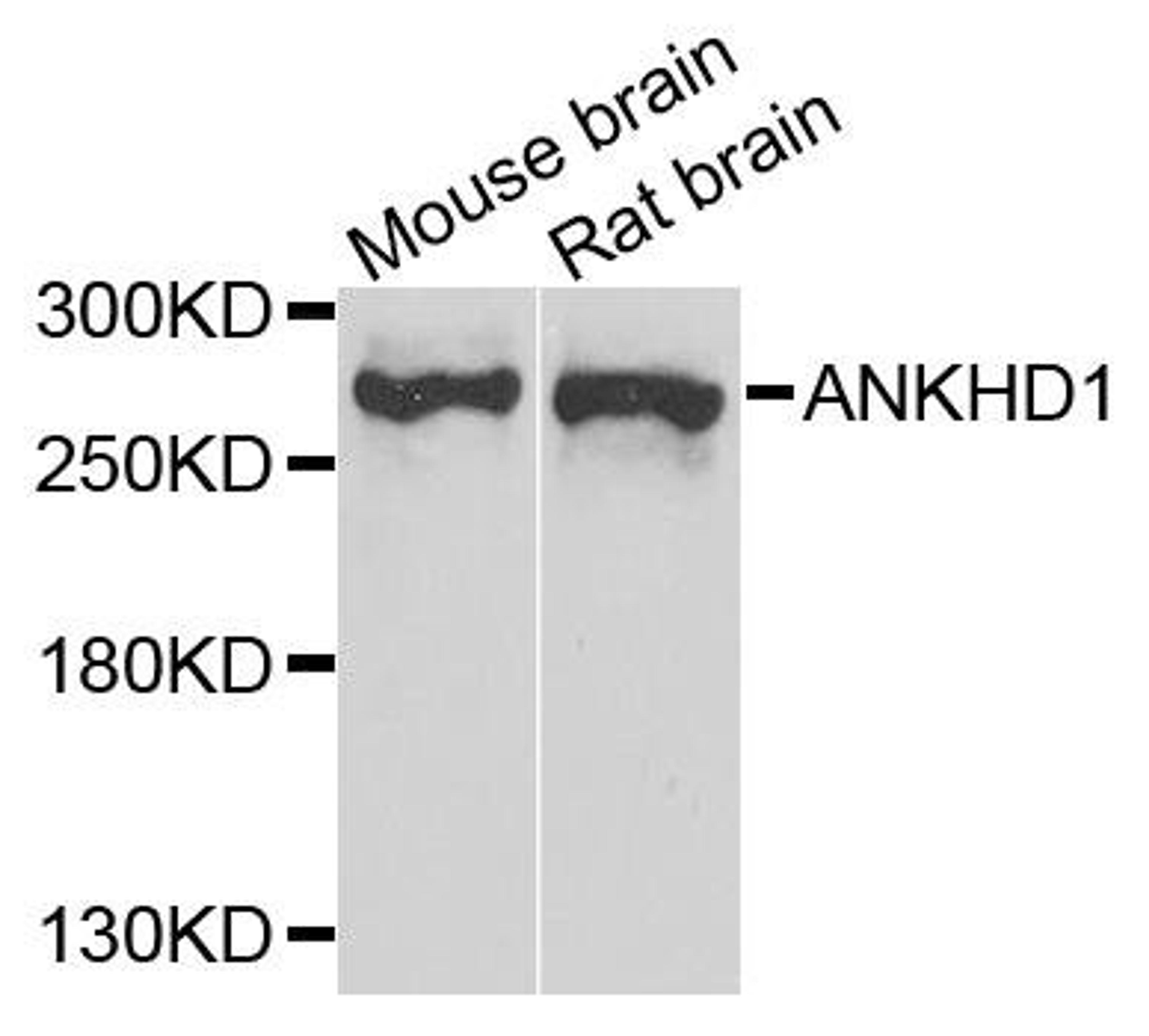 Western blot analysis of extract of various cells using ANKHD1 antibody