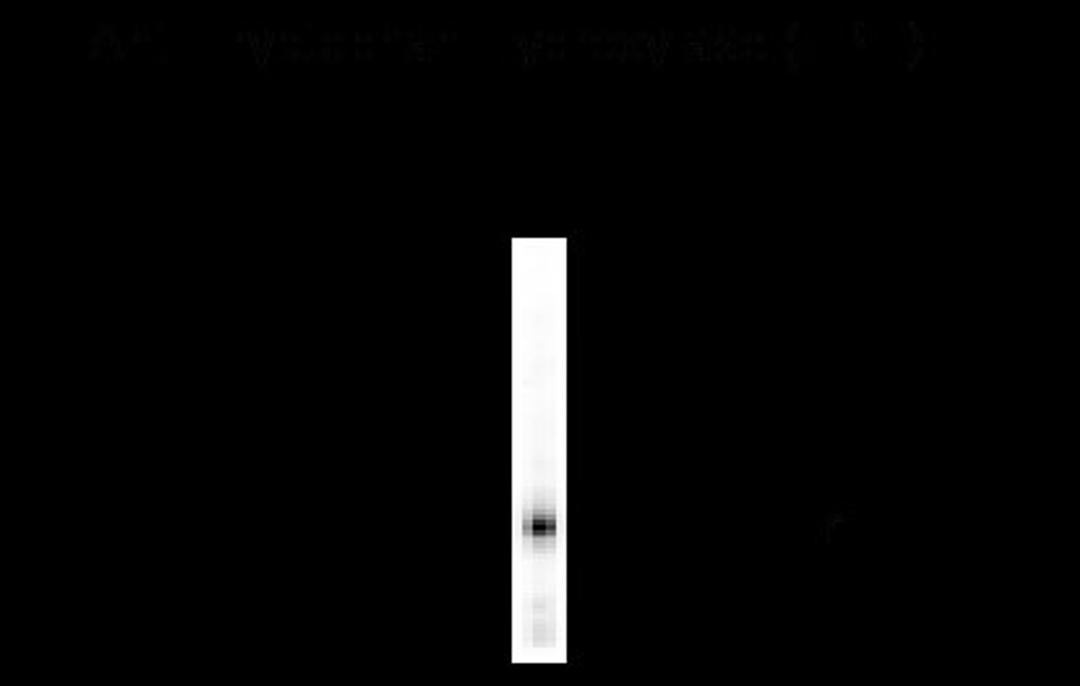 Tryptophan Hydroxylase Antibody