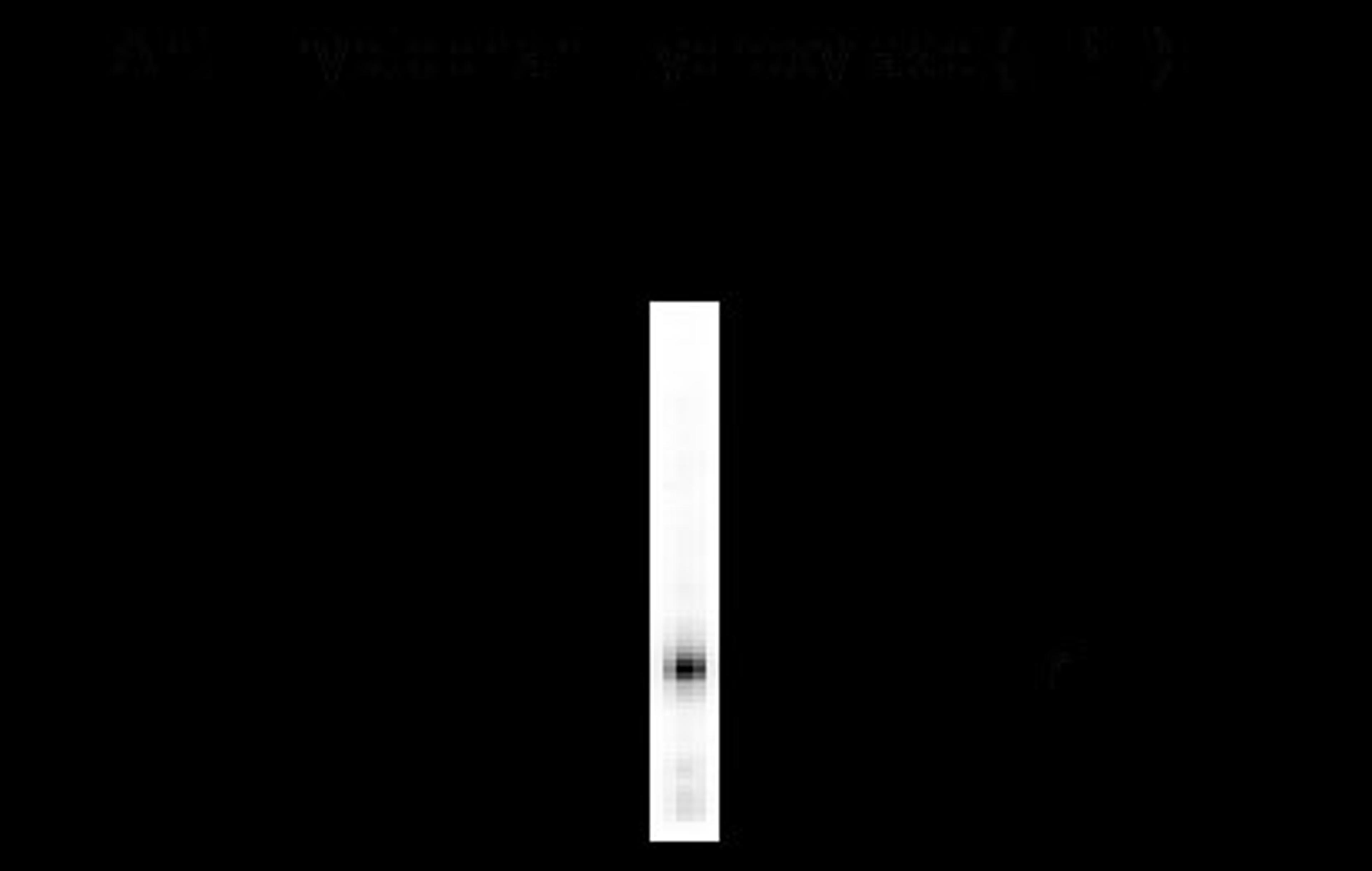 Tryptophan Hydroxylase Antibody