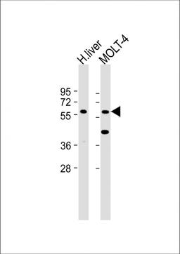 Western Blot at 1:2000 dilution Lane 1: Human liver lysate Lane 2: MOLT-4 whole cell lysate Lysates/proteins at 20 ug per lane.