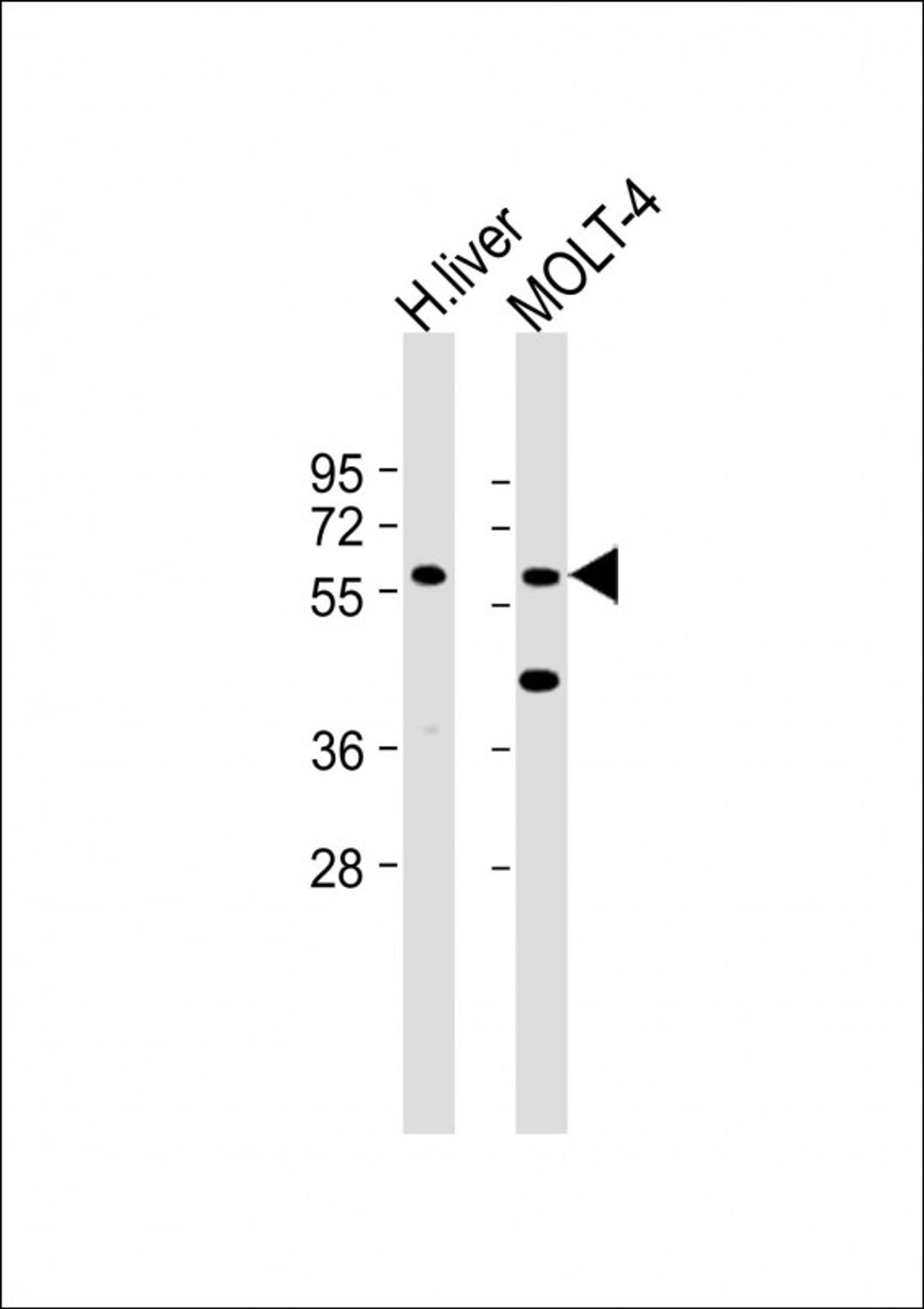 Western Blot at 1:2000 dilution Lane 1: Human liver lysate Lane 2: MOLT-4 whole cell lysate Lysates/proteins at 20 ug per lane.