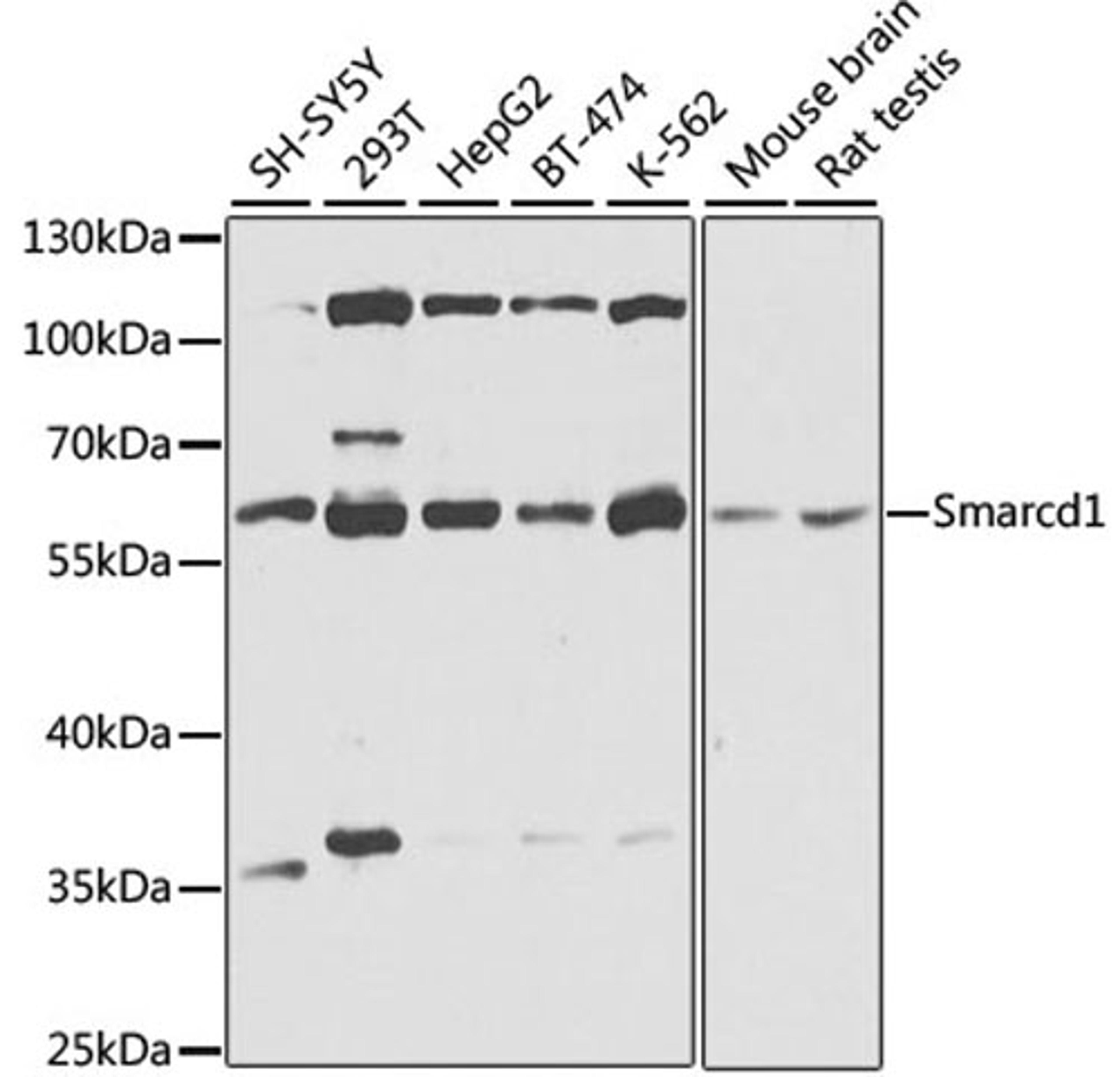 Western blot - Smarcd1 antibody (A9950)