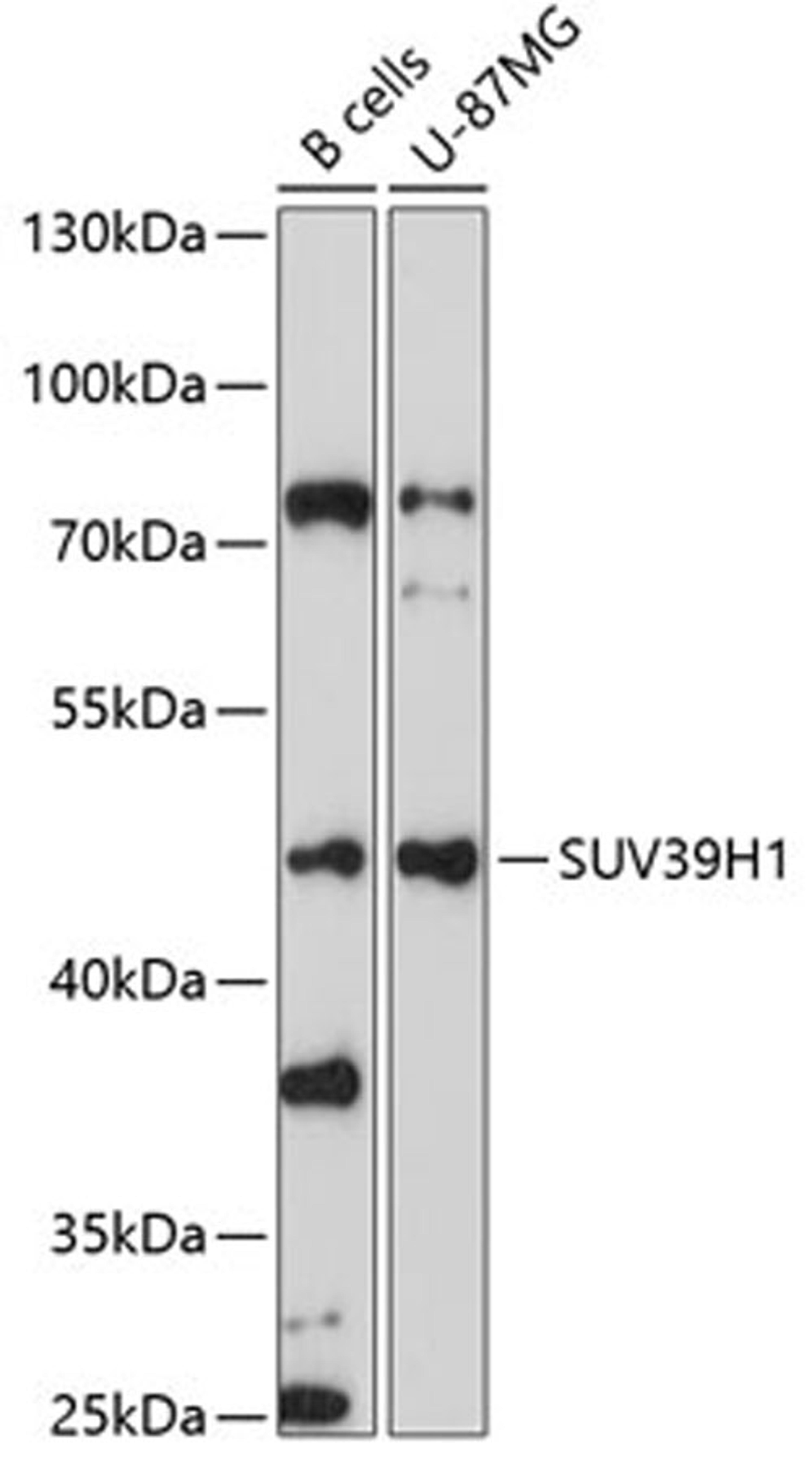 Western blot - SUV39H1 antibody (A3277)