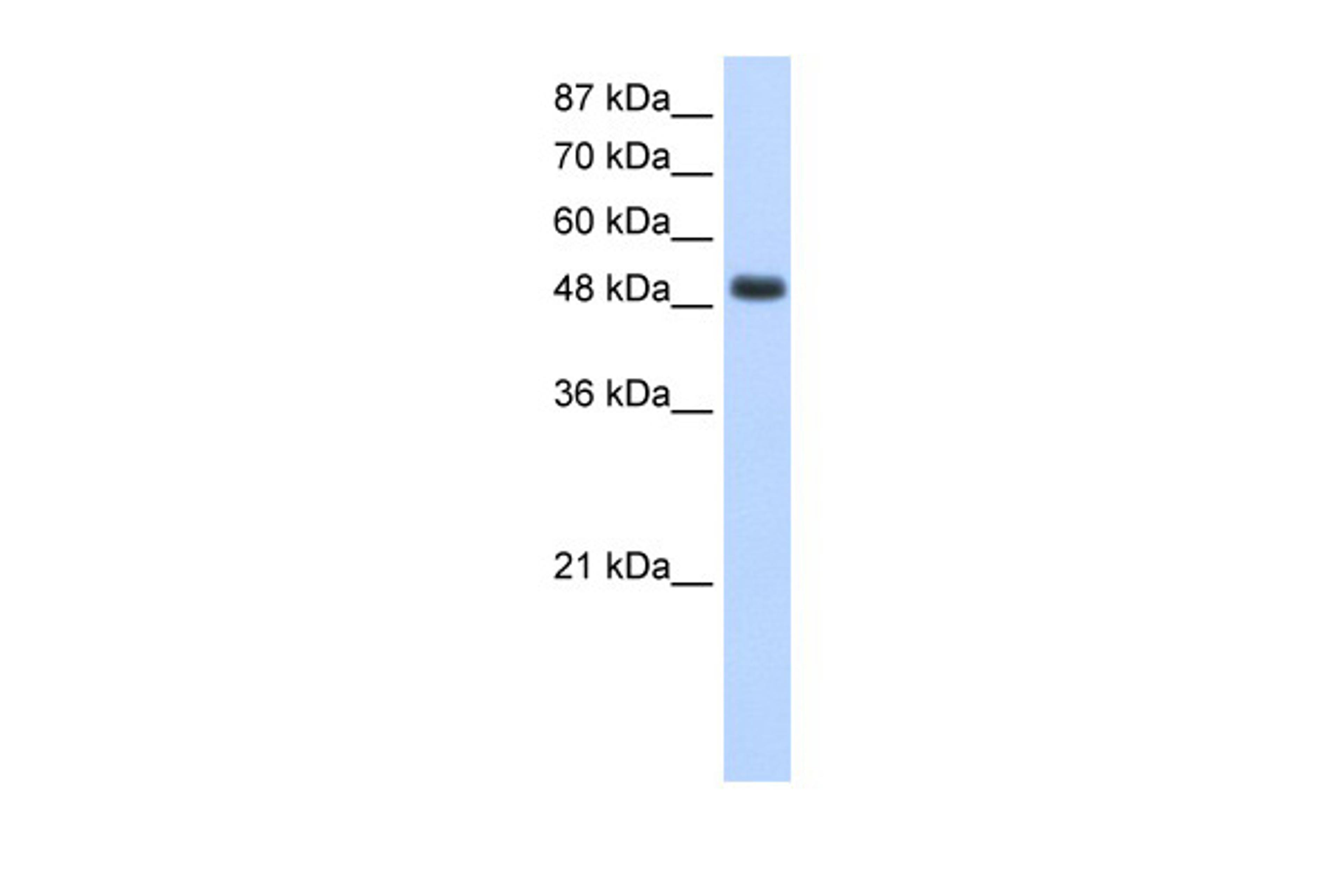 Antibody used in WB on Human HepG2 cells at 1.25 ug/ml.