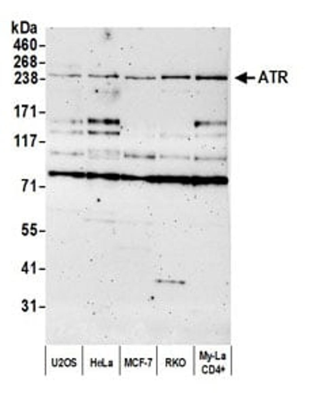 Detection of human ATR by western blot.