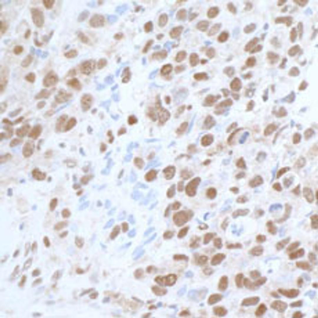 Detection of human CARM1 by immunohistochemistry.