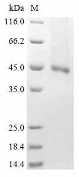 (Tris-Glycine gel) Discontinuous SDS-PAGE (reduced) with 5% enrichment gel and 15% separation gel.