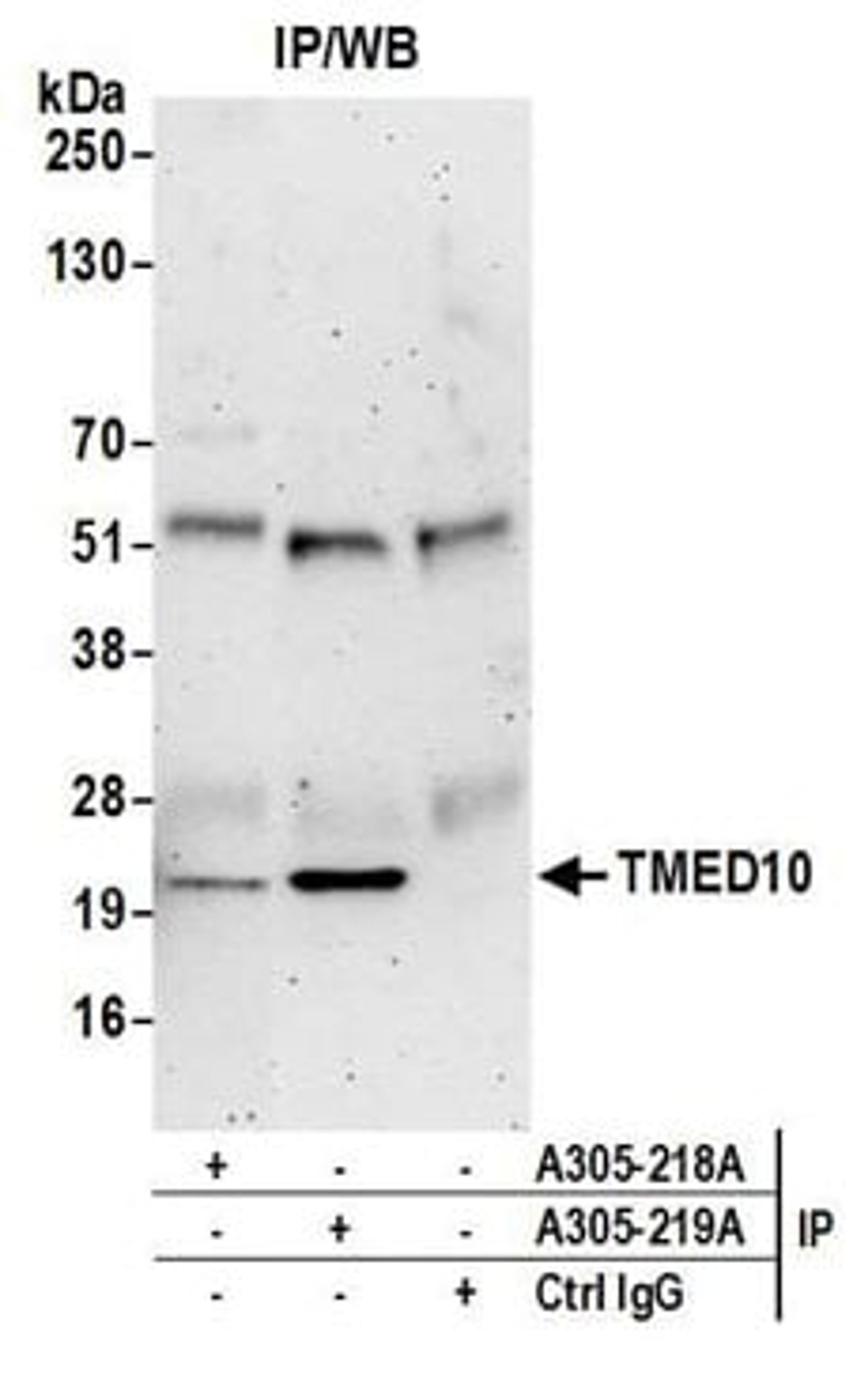 Detection of human TMED10 by western blot of immunoprecipitates.