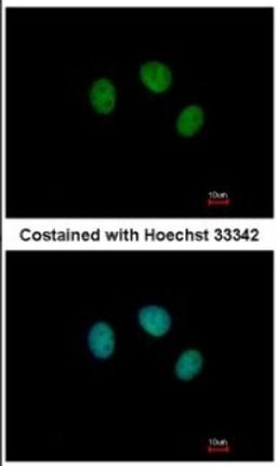 Immunocytochemistry/Immunofluorescence: ZNF345 Antibody [NBP2-20996] - Analysis of paraformaldehyde-fixed MCF-7, using antibody at 1:500 dilution.