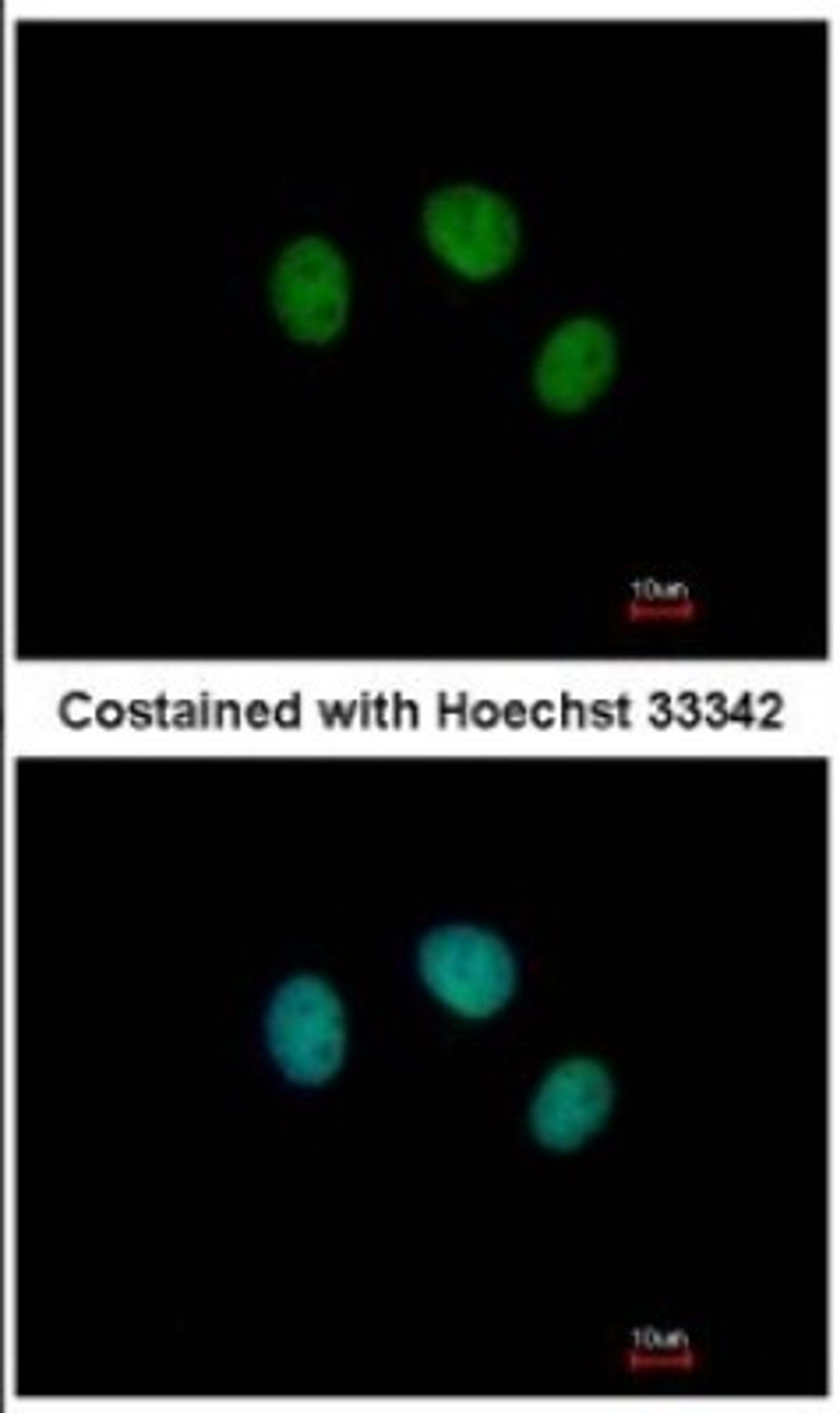 Immunocytochemistry/Immunofluorescence: ZNF345 Antibody [NBP2-20996] - Analysis of paraformaldehyde-fixed MCF-7, using antibody at 1:500 dilution.