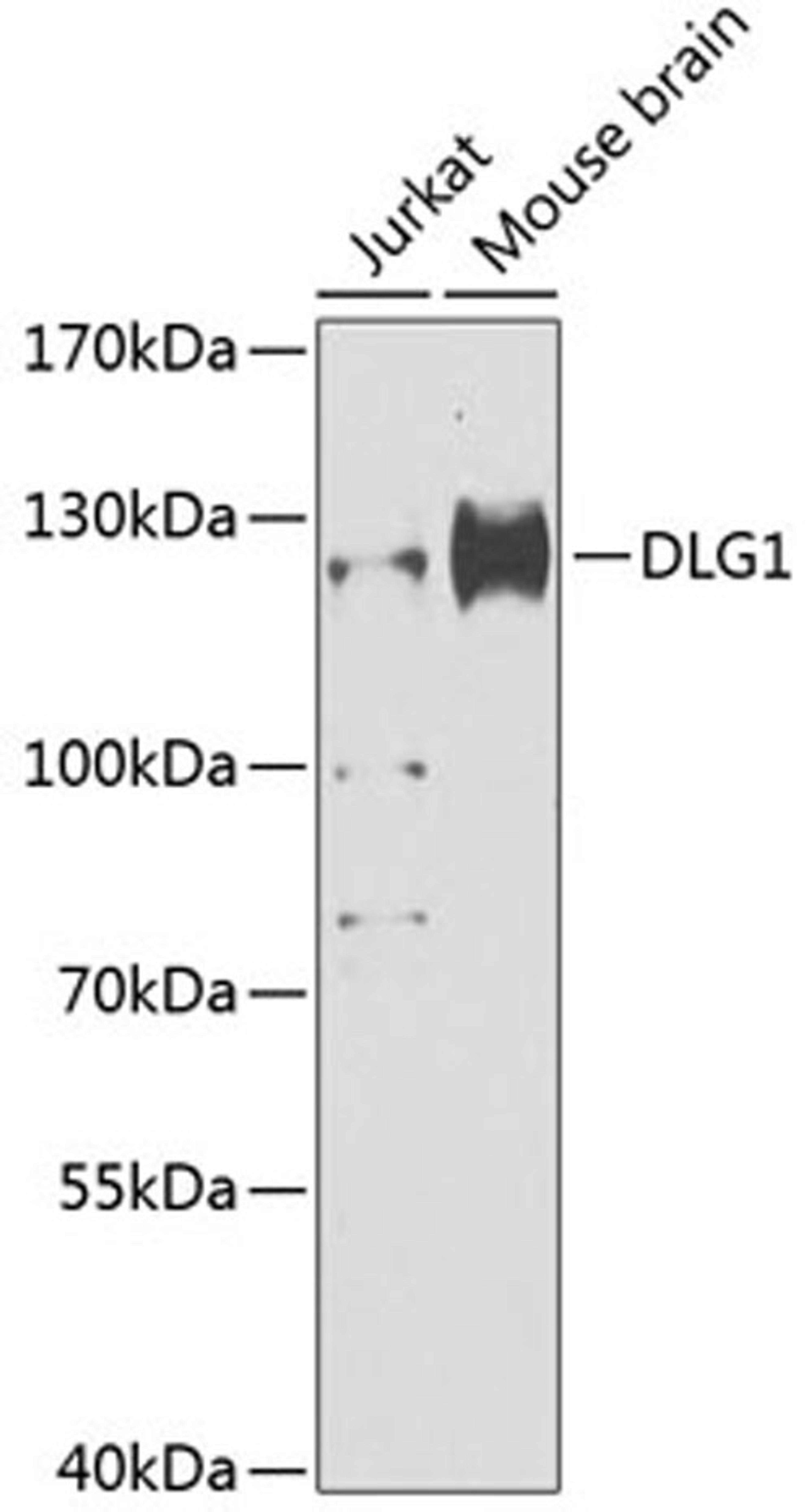 Western blot - DLG1 antibody (A12432)