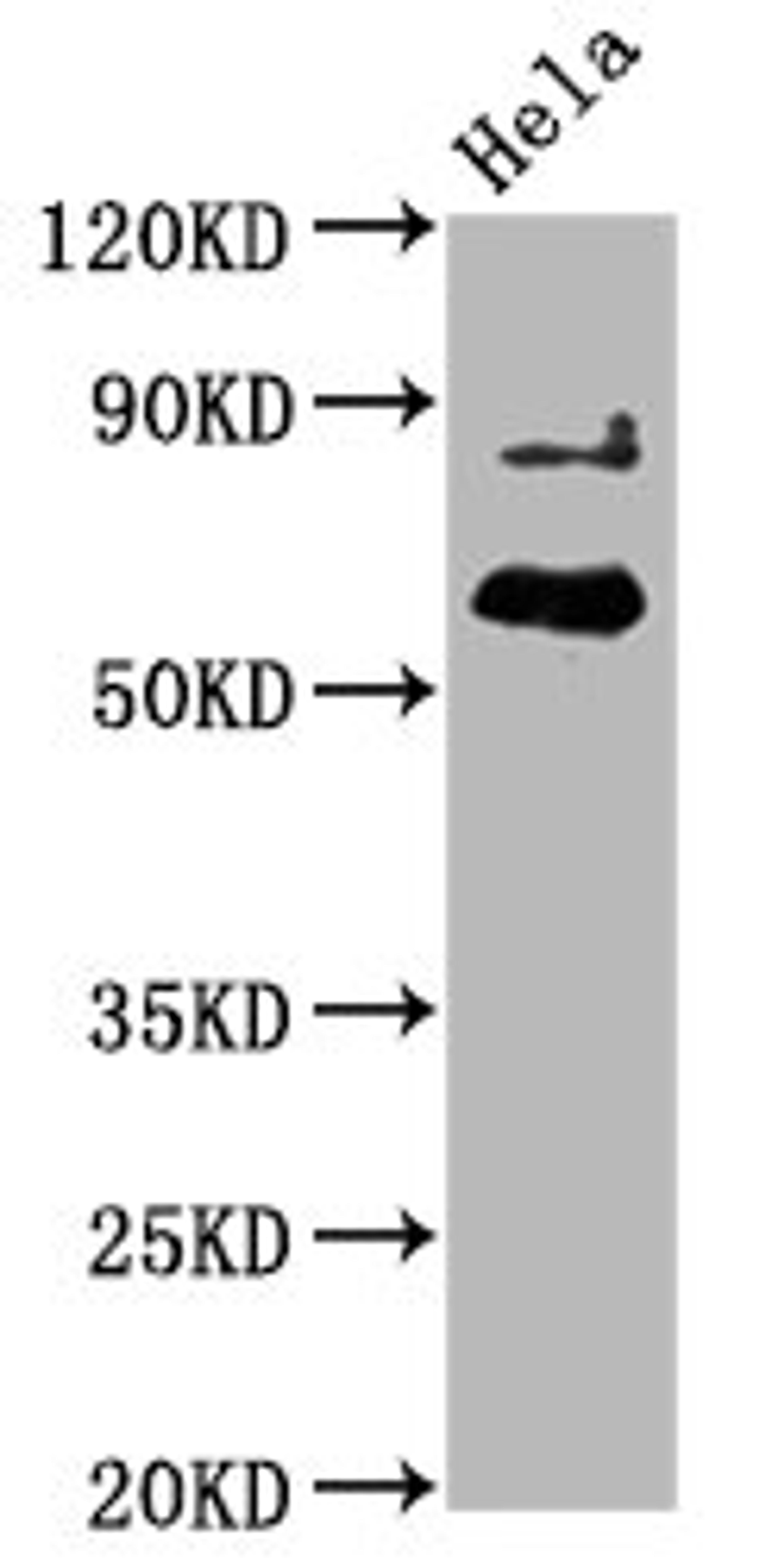 Western Blot. Positive WB detected in Hela whole cell lysate. All lanes Phospho-AKT1 antibody at 2.25μg/ml. Secondary. Goat polyclonal to rabbit IgG at 1/50000 dilution. Predicted band size: 60 KDa. Observed band size: 60 KDa.