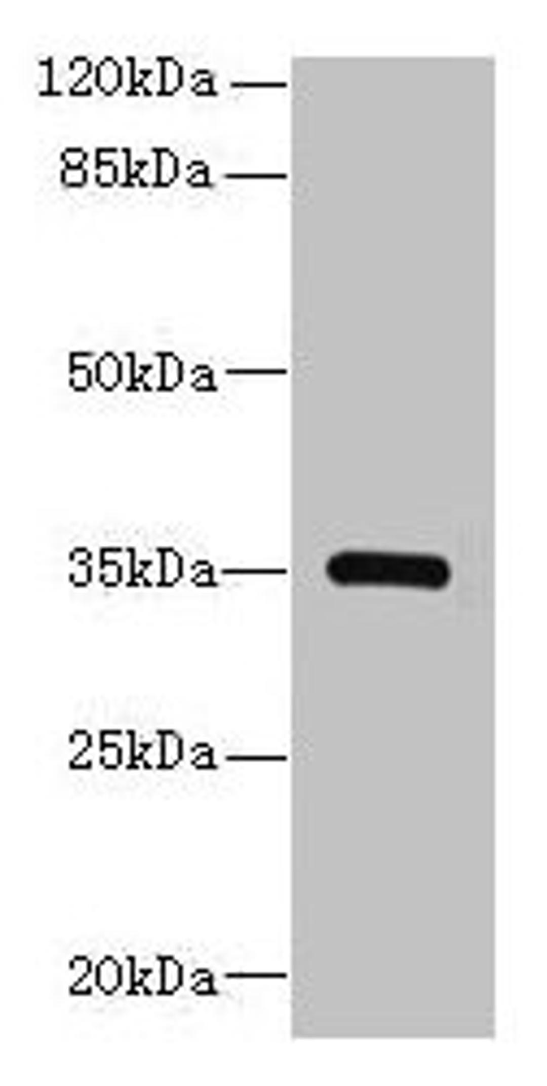 Western blot. All lanes: STX19 antibody at 2µg/ml + K562 whole cell lysate. Secondary. Goat polyclonal to rabbit IgG at 1/10000 dilution. Predicted band size: 35 kDa. Observed band size: 35 kDa