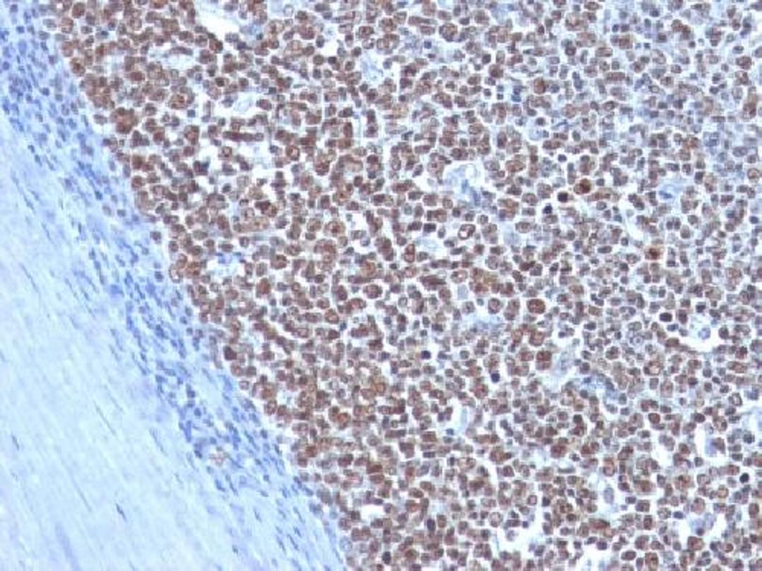 Immunohistochemical staining of human Tonsil tissue using CCNB1 antibody