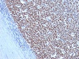 Immunohistochemical staining of human Tonsil tissue using CCNB1 antibody