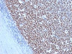 Immunohistochemical staining of human Tonsil tissue using CCNB1 antibody