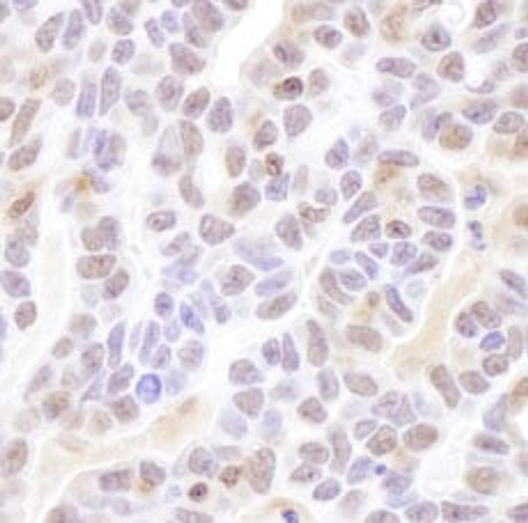 Detection of human Coilin by immunohistochemistry.