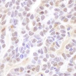 Detection of human Coilin by immunohistochemistry.