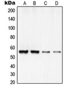 Western blot analysis of HeLa (Lane 1), A549 (Lane 2), MOLT4 (Lane 3), NIH3T3 (Lane 4) whole cell lysates using RCC2 antibody