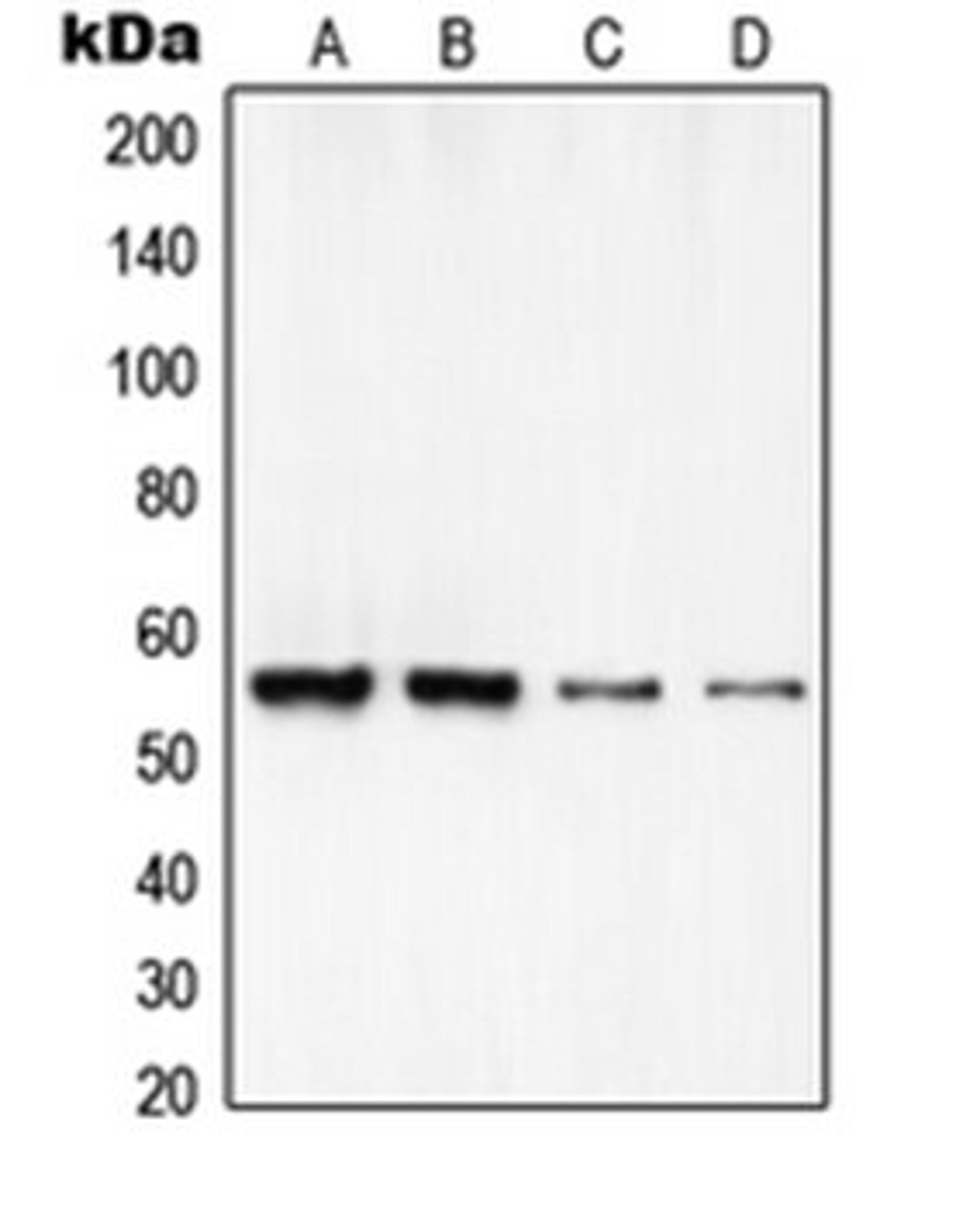 Western blot analysis of HeLa (Lane 1), A549 (Lane 2), MOLT4 (Lane 3), NIH3T3 (Lane 4) whole cell lysates using RCC2 antibody