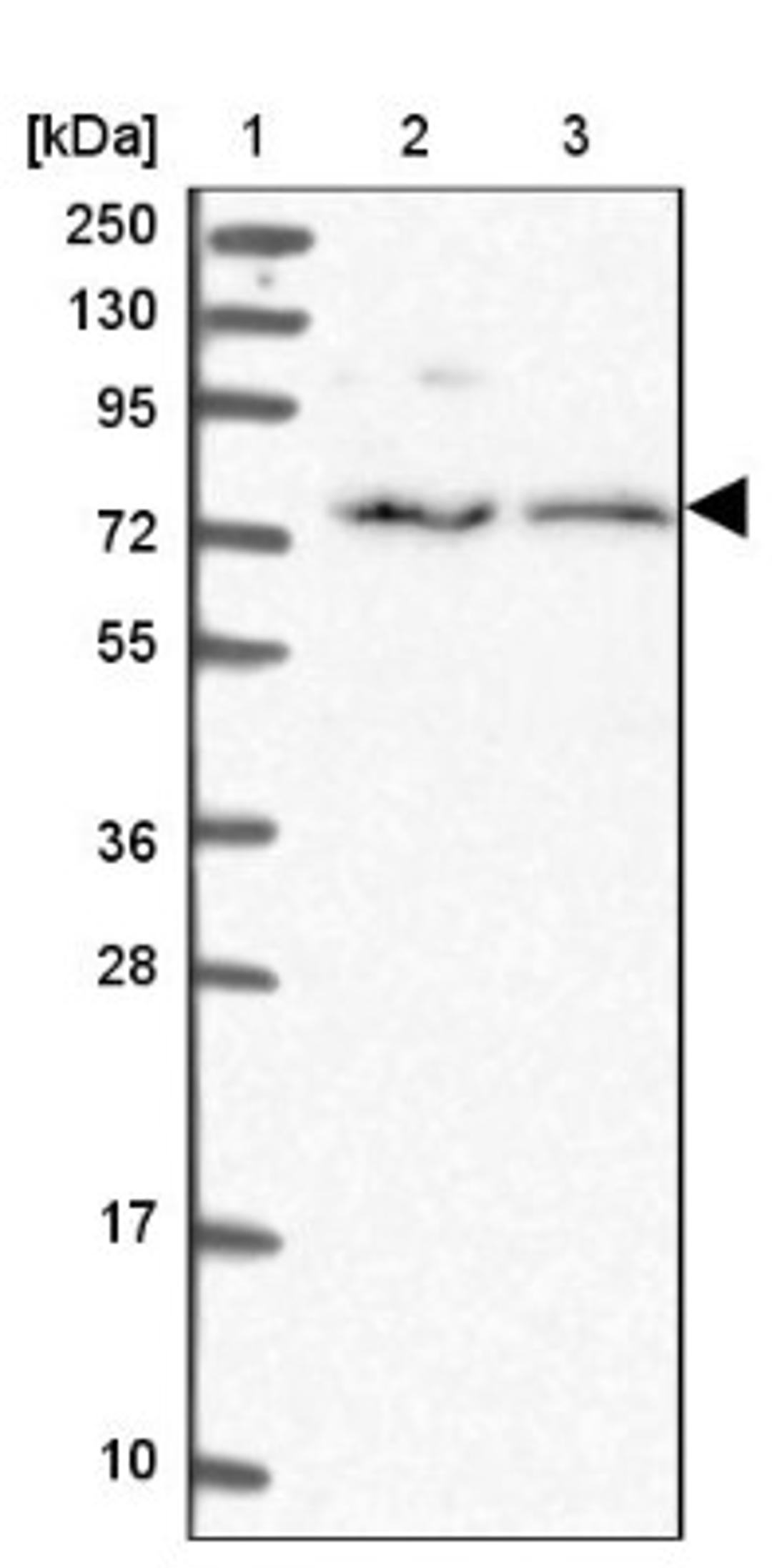 Western Blot: CPNE7 Antibody [NBP1-85827] - Lane 1: Marker [kDa] 250, 130, 95, 72, 55, 36, 28, 17, 10<br/>Lane 2: Human cell line RT-4<br/>Lane 3: Human cell line U-251MG sp