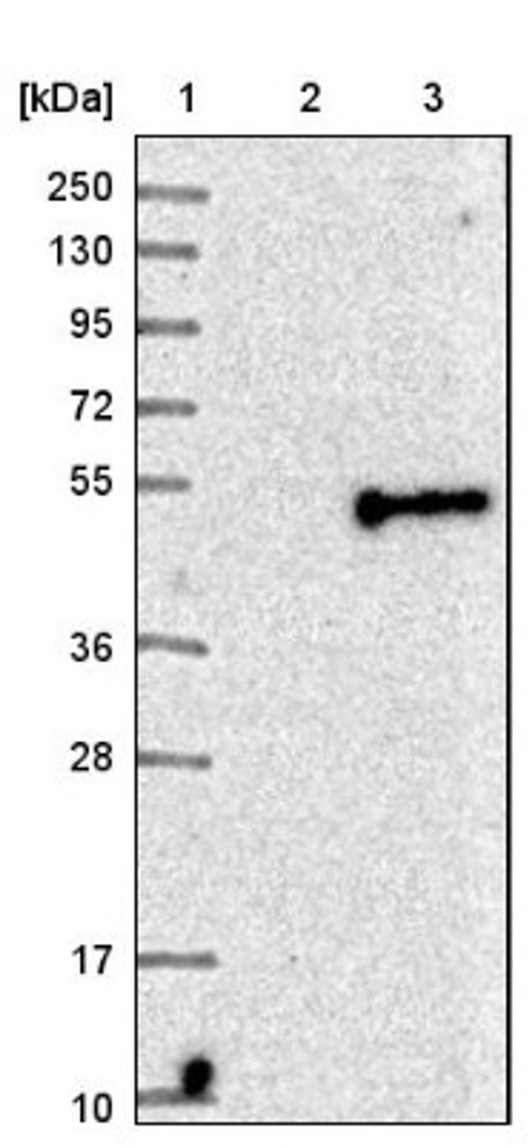 Western Blot: CD276 Antibody [NBP1-88965] - Lane 1: Marker [kDa] 250, 130, 95, 72, 55, 36, 28, 17, 10<br/>Lane 2: Negative control (vector only transfected HEK293T lysate)<br/>Lane 3: Over-expression lysate (Co-expressed with a C-terminal myc-DDK tag (~3.1 kDa) in mammalian HEK293T cells, LY410803)