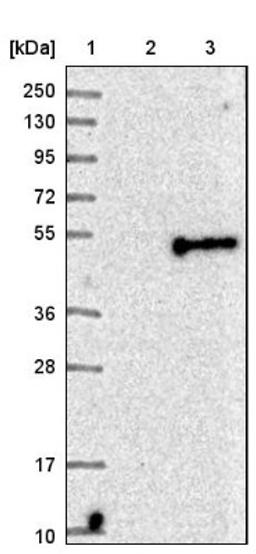 Western Blot: CD276 Antibody [NBP1-88965] - Lane 1: Marker [kDa] 250, 130, 95, 72, 55, 36, 28, 17, 10<br/>Lane 2: Negative control (vector only transfected HEK293T lysate)<br/>Lane 3: Over-expression lysate (Co-expressed with a C-terminal myc-DDK tag (~3.1 kDa) in mammalian HEK293T cells, LY410803)