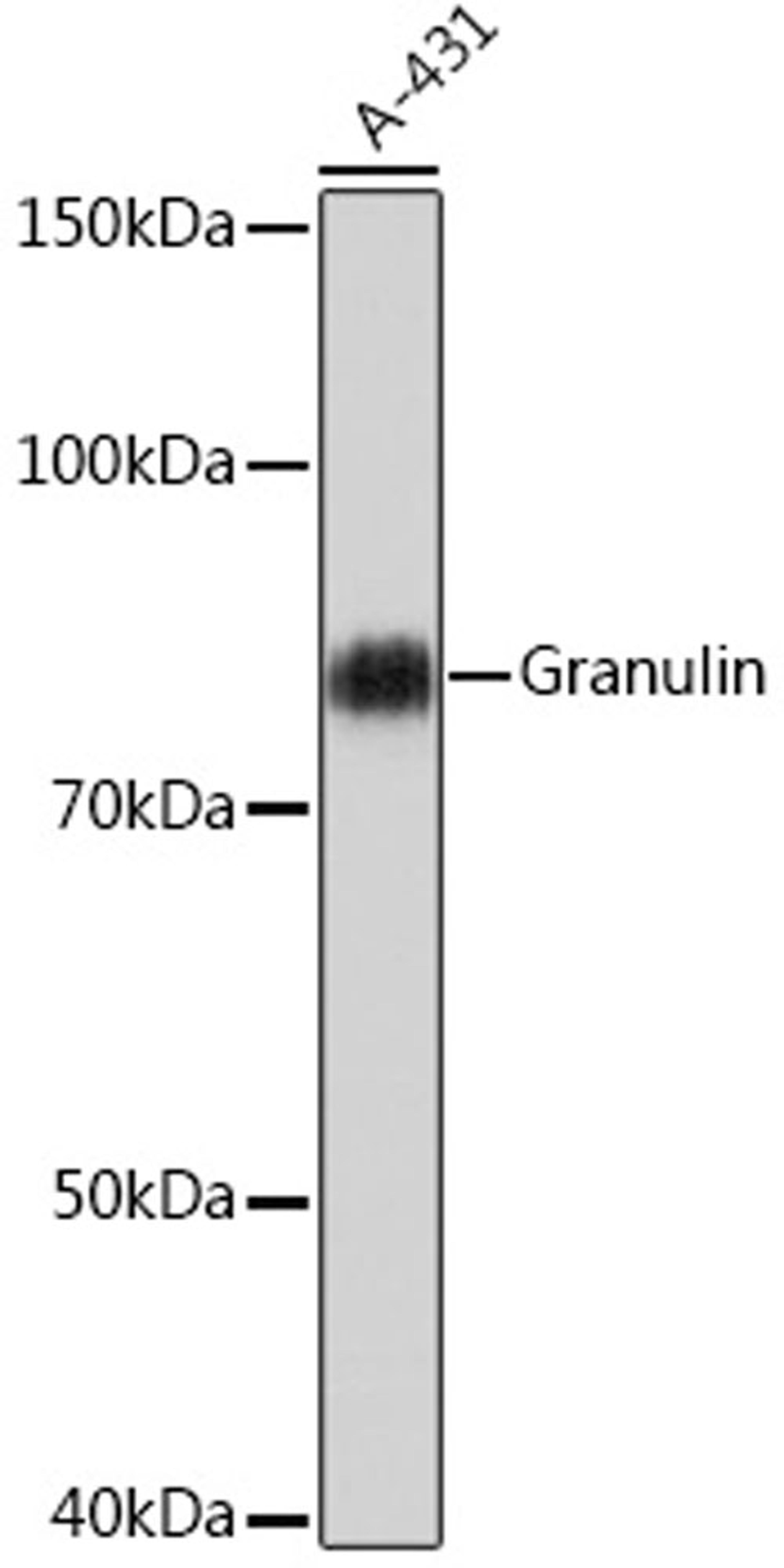 Western blot - Granulin Rabbit mAb (A5124)