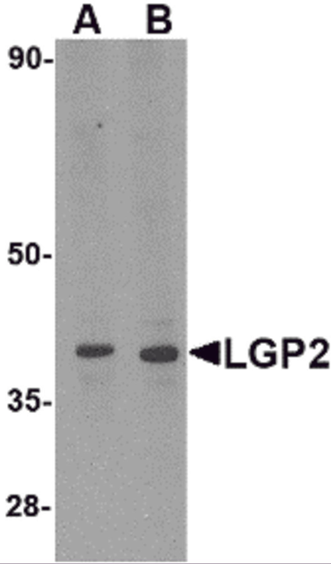 Western blot analysis of LGP2 in MDA-MB-361 cell lysate with LGP2 antibody at (A) 0.5 and (B) 1 μg/mL.