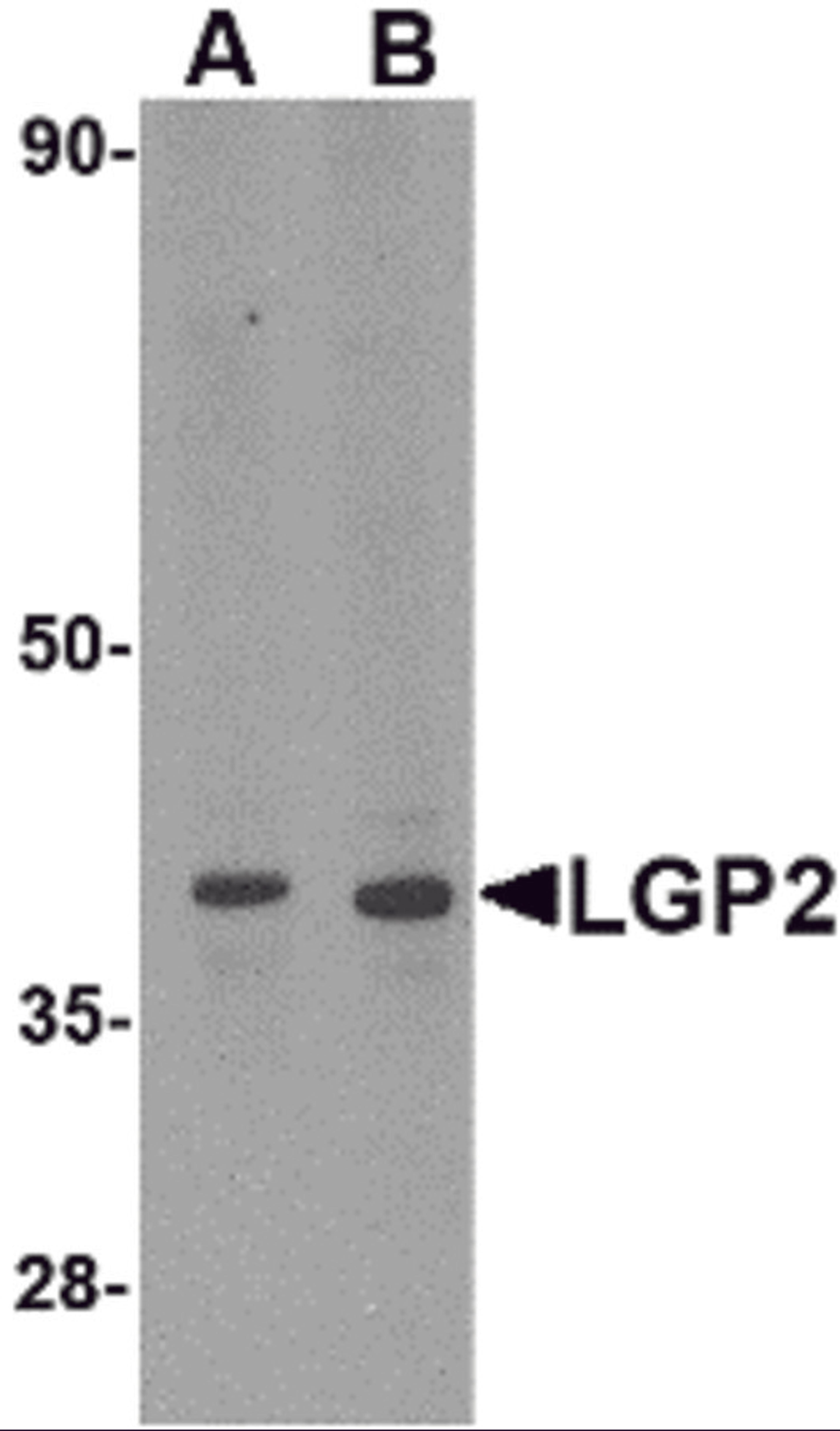 Western blot analysis of LGP2 in MDA-MB-361 cell lysate with LGP2 antibody at (A) 0.5 and (B) 1 μg/mL.