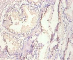 Immunohistochemistry of paraffin-embedded human prostate tissue using CSB-PA17444A0Rb at dilution of 1:100