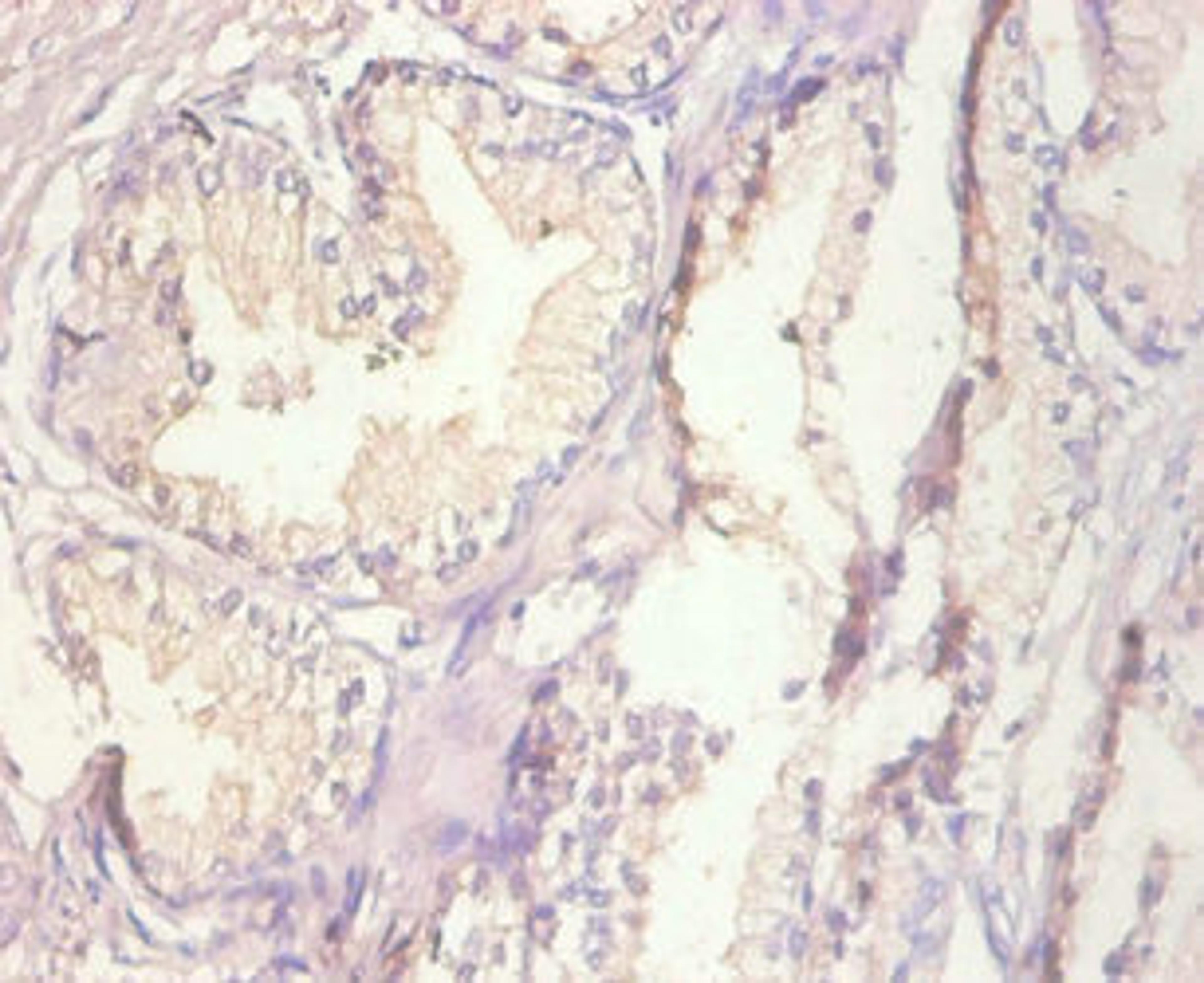 Immunohistochemistry of paraffin-embedded human prostate tissue using CSB-PA17444A0Rb at dilution of 1:100
