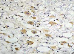 Immunohistochemical analysis of paraffin-embedded rat brain tissue using ZO-1 antibody