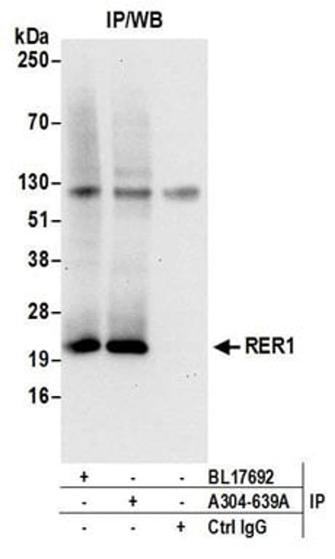 Detection of human RER1 by western blot of immunoprecipitates.