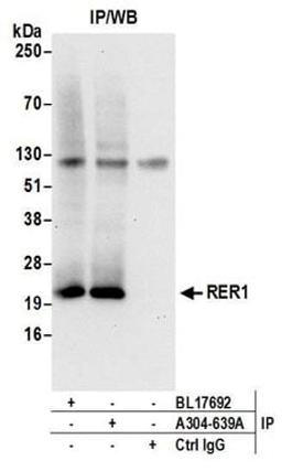 Detection of human RER1 by western blot of immunoprecipitates.