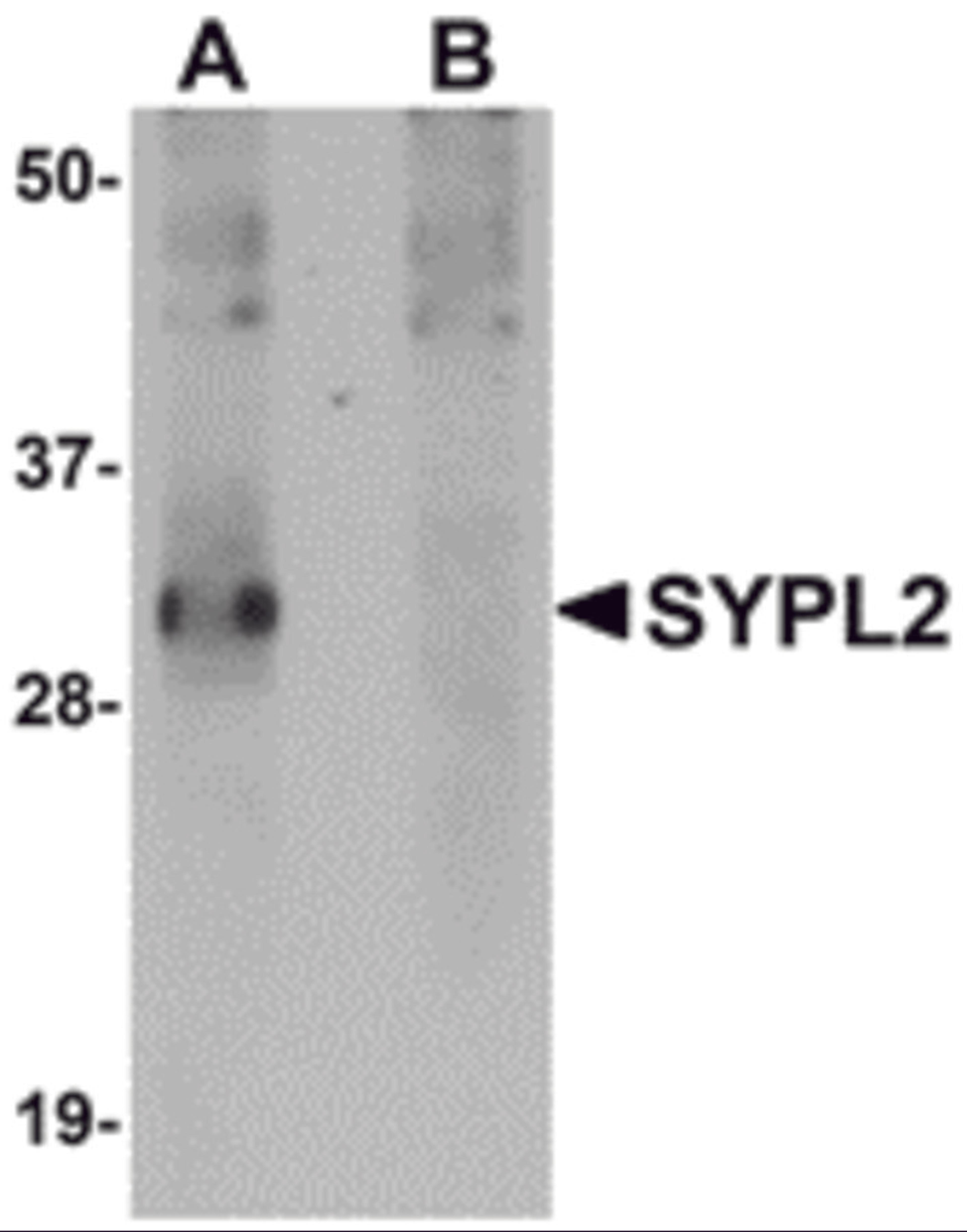 Western blot analysis of SYPL2 in human spleen tissue lysate with SYPL2 antibody at 1 &#956;g/mL in (A) the absence and (B) the presence of blocking peptide.